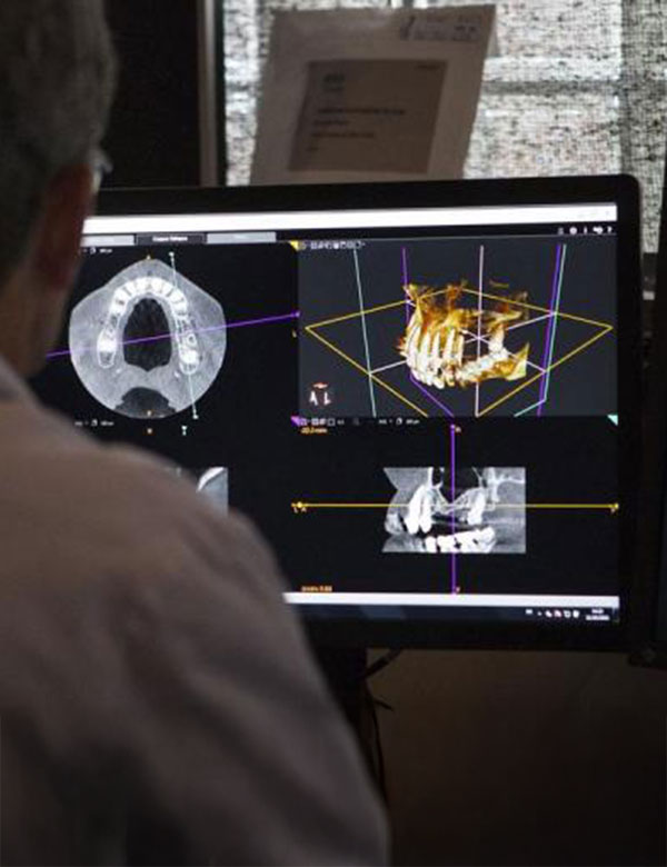 蒲田のインプラント専門医院、のびのび歯科・矯正歯科